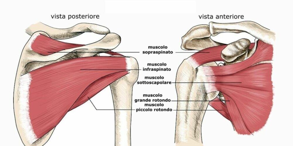 Bruciore spalla