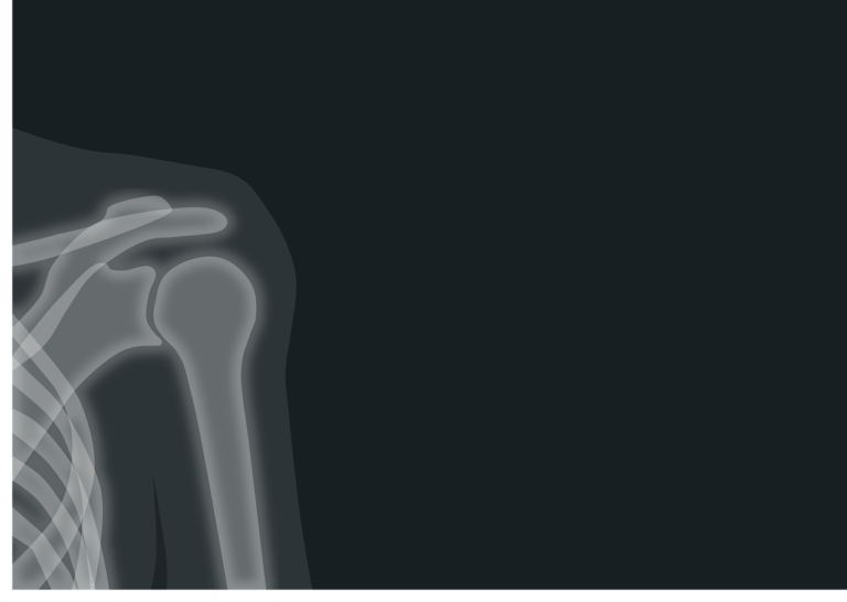 roentgen, x-ray image, radiation-1884888.jpg